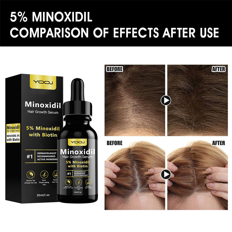 Minoxidil Hair oil